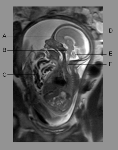 Universitätsklinikum Heidelberg: Neuroradiologie UKHD – Untersuchungen ...